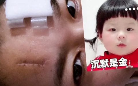 打人拘留几天？律师全面解析打架斗殴法律后果