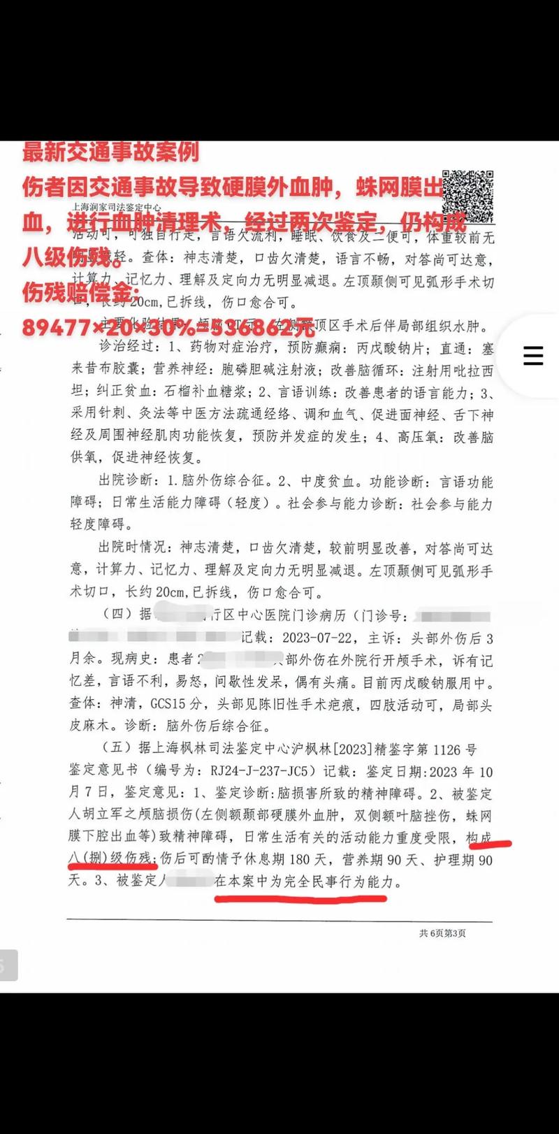 工伤八级赔偿解惑：20万并非定数，看关键因素