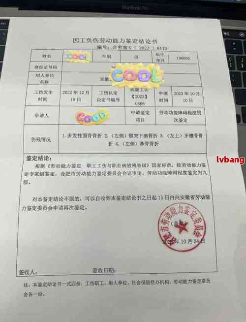工伤鉴定老板必须陪同吗？资深律师为你解开疑惑