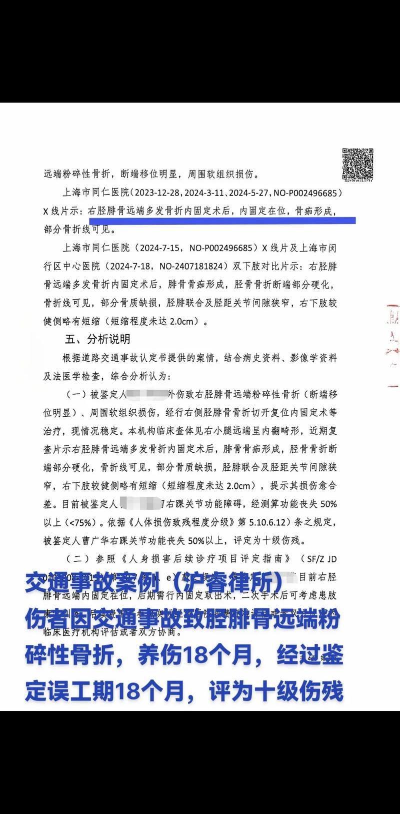 小腿骨折工伤能评几级？赔偿项目和标准详解
