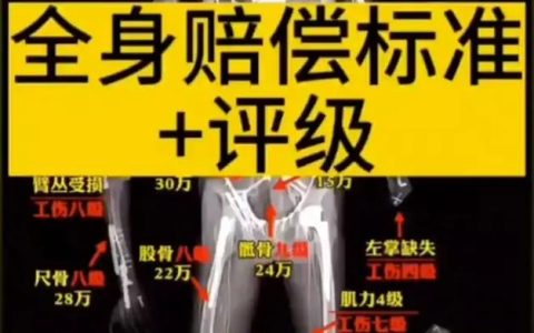 工伤骨折别慌：赔偿标准与权益保障全解析