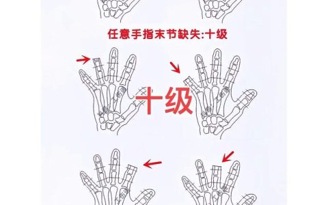 手指伤残等级评定详解
