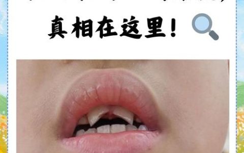 门牙断了一半能评残吗？法律实务解析