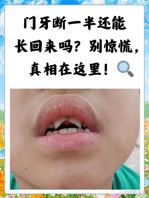 门牙断了一半能评残吗？法律实务解析