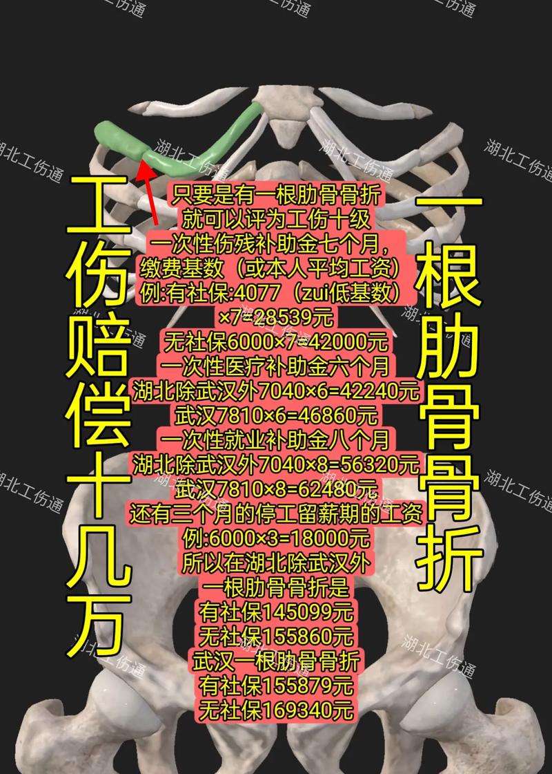 骨折工伤赔偿标准与实务指南