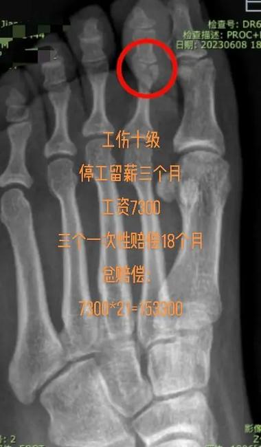 工伤认定与赔偿全流程解析及最新标准说明