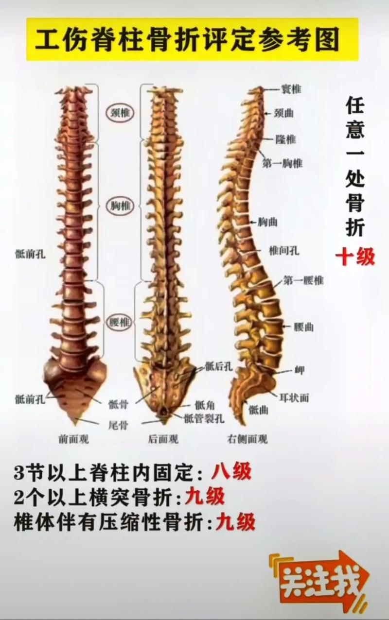 工伤赔偿标准详解：1-10级伤残待遇全面指南