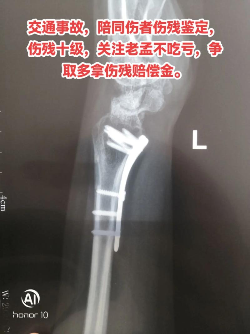 伤情伤残鉴定哪里办？一文读懂流程与关键点
