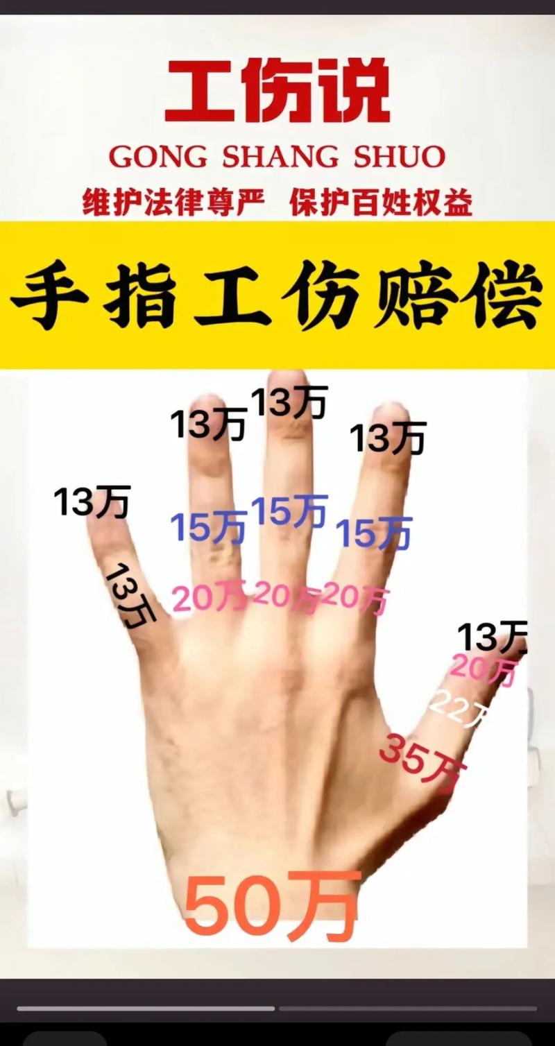 手指工伤赔偿标准与流程详解