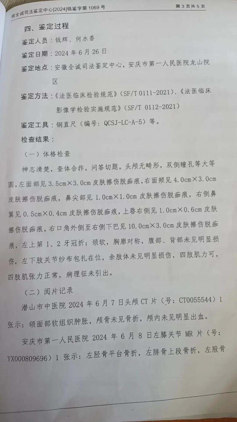 收到错误鉴定意见？推翻它的法律途径详解