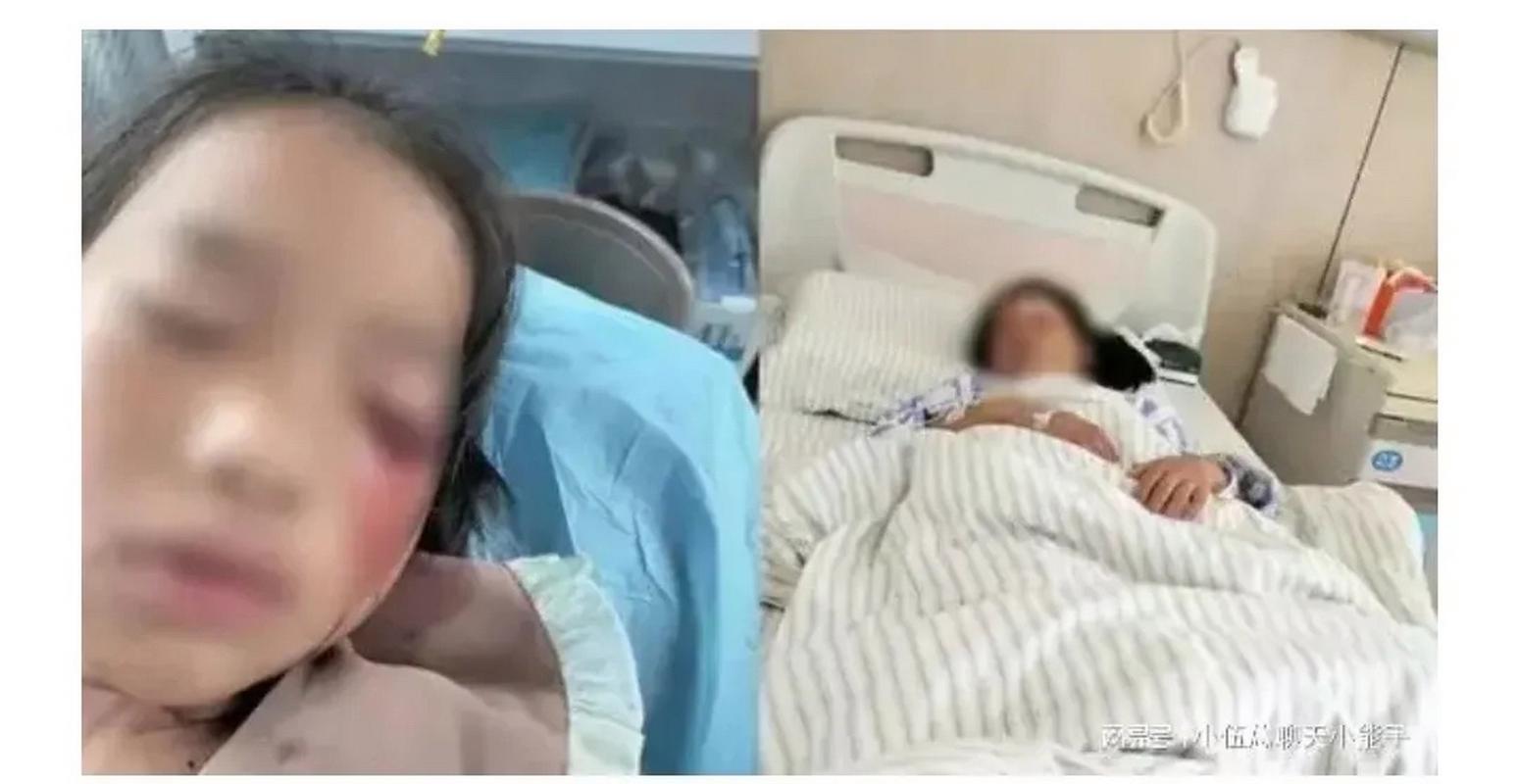 冲动之下打瞎他人眼睛？法律后果远比你想的更严重
