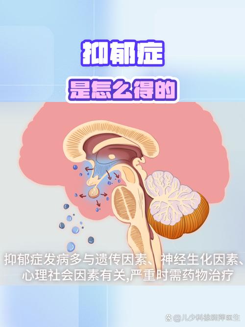 抑郁并非空穴来风：探究其复杂的形成根源