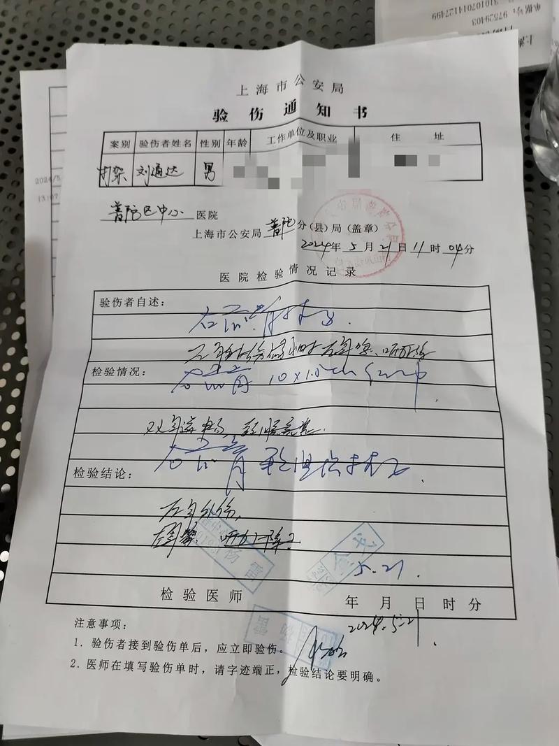 肇事逃逸法律后果多严重？