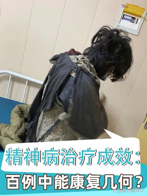 精神病人算残疾吗？法律认定与权益全解析