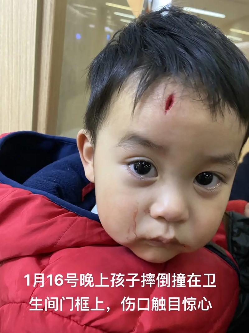 额头缝针疤痕恢复：实用指南与法律维权
