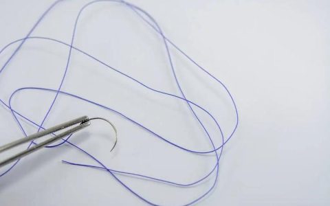 二次缝合后拆线时间与注意事项解析