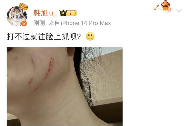 一记耳光的法律代价：后果可能远超你想象
