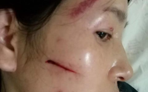 家庭暴力诉讼时效有多久？律师深度解读关键期限