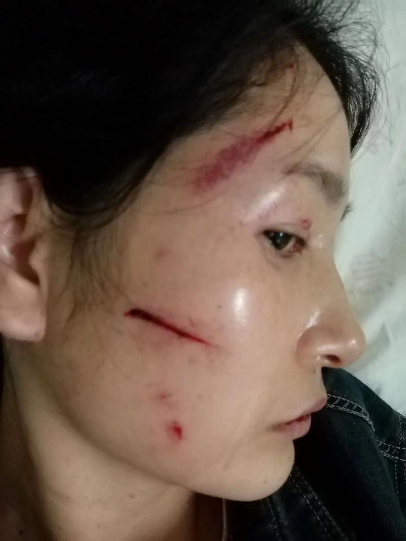 家庭暴力诉讼时效有多久？律师深度解读关键期限